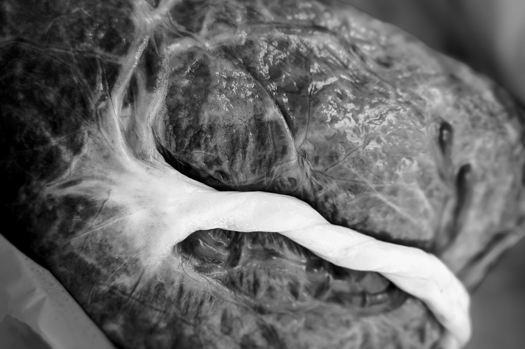 Funky Facts: Placentas and&nbsp;Cords